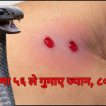 बर्खा र गर्मीसँगै सर्पदंशको उच्च जोखिम
